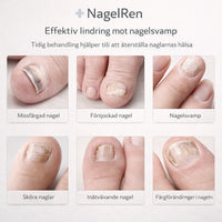 NagelRen – För friskare och klarare naglar hemma